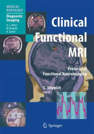 Clinical Functional MRI: Presurgical Functional Neuroimaging de K. Sartor