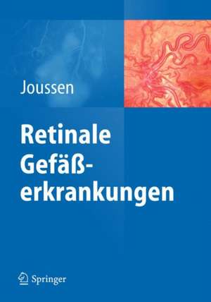 Retinale Gefäßerkrankungen de Antonia Joussen