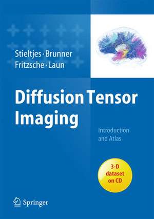 Diffusion Tensor Imaging: Introduction and Atlas de Bram Stieltjes