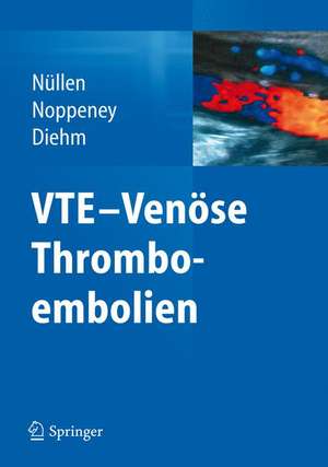 VTE - Venöse Thromboembolien de Helmut Nüllen