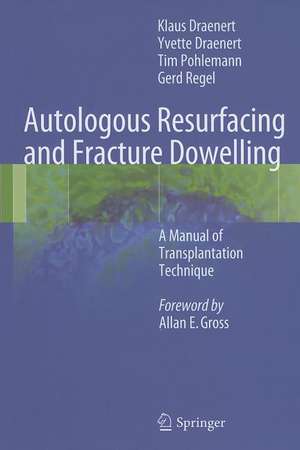 Autologous Resurfacing and Fracture Dowelling: A Manual of Transplantation Technique de Klaus Draenert