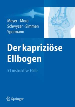 Der kapriziöse Ellbogen: 51 instruktive Fälle de Rainer-Peter Meyer