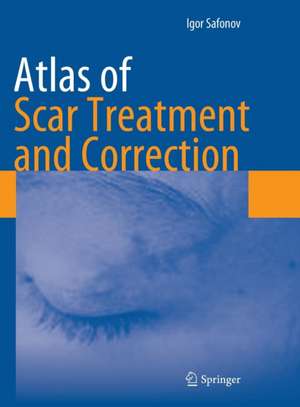 Atlas of Scar Treatment and Correction de Igor Safonov