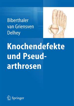 Knochendefekte und Pseudarthrosen de Peter Biberthaler