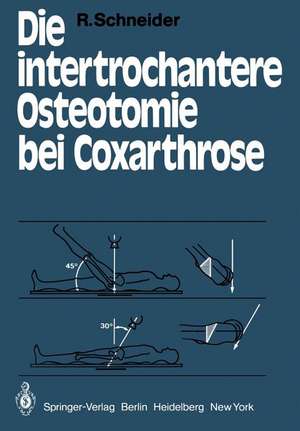 Die intertrochantere Osteotomie bei Coxarthrose de R. Schneider