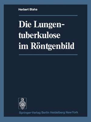 Die Lungentuberkulose im Röntgenbild de H. Blaha