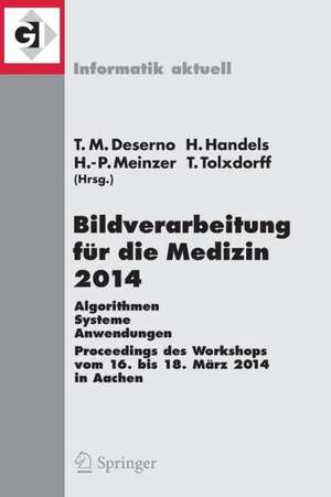 Bildverarbeitung für die Medizin 2014: Algorithmen - Systeme - Anwendungen Proceedings des Workshops vom 16. bis 18. März 2014 in Aachen de Thomas Martin Deserno