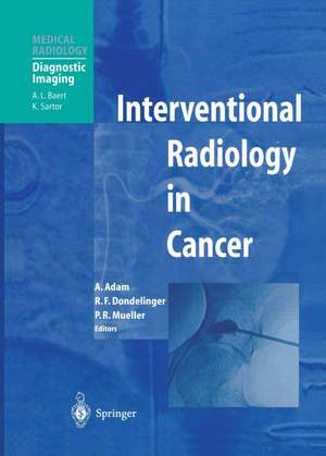 Interventional Radiology in Cancer de Andreas Adam