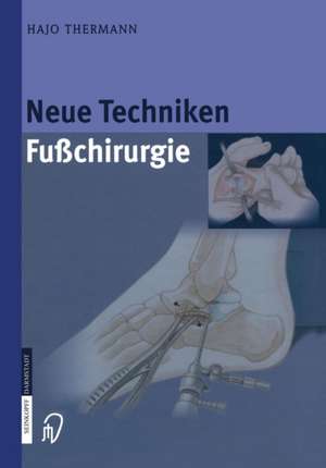 Neue Techniken Fusschirurgie de Hajo Thermann