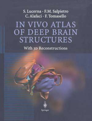 In Vivo Atlas of Deep Brain Structures: With 3D Reconstructions de S. Lucerna