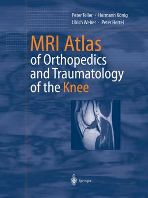 MRI Atlas of Orthopedics and Traumatology of the Knee de Peter Teller