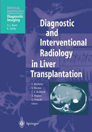 Diagnostic and Interventional Radiology in Liver Transplantation de E. Bücheler