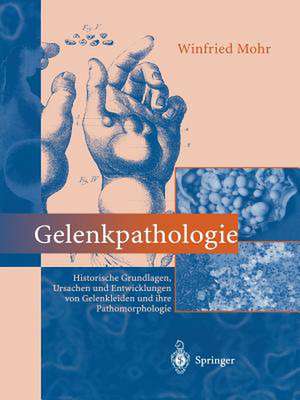 Gelenkpathologie: Historische Grundlagen, Ursachen und Entwicklungen von Gelenkleiden und ihre Pathomorphologie de R. Endres-Klein