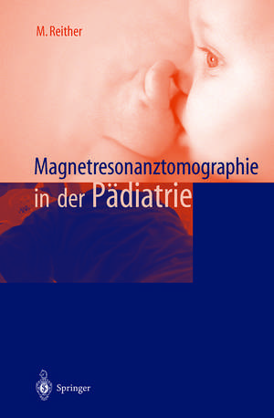 Magnetresonanztomographie in der Pädiatrie de M. Reither