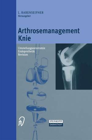 Arthrosemanagement Knie: Umstellungsosteotomie — Endoprothetik — Revision de L. Rabenseifner