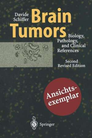 Brain Tumors: Biology, Pathology and Clinical References de M.T. Giordana