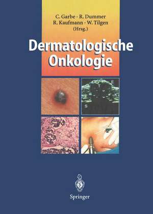 Dermatologische Onkologie de Claus Garbe