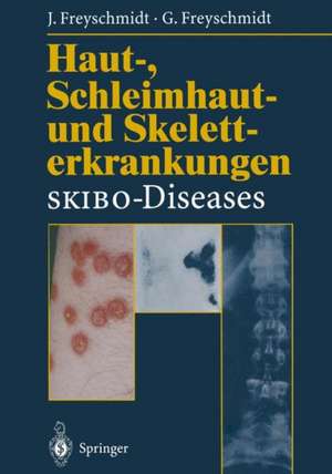 Haut-, Schleimhaut- und Skeletterkrankungen SKIBO-Diseases: Eine dermatologische-klinisch-radiologische Synopse de Jürgen Freyschmidt