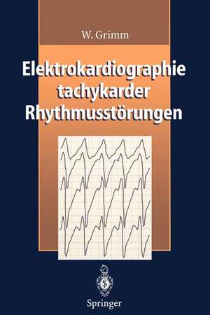 Elektrokardiographie tachykarder Rhythmusstörungen de W. Grimm