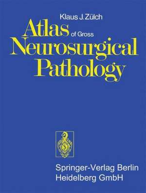 Atlas of Gross Neurosurgical Pathology de K. J. Zülch