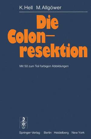 Die Colonresektion de K. Hell