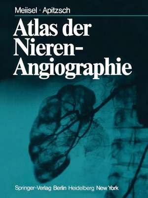 Atlas der Nierenangiographie de L. Laasonen