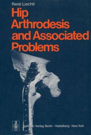 Hip Arthrodesis and Associated Problems de R. Liechti