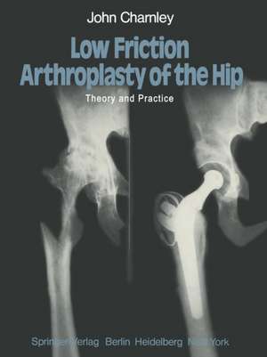 Low Friction Arthroplasty of the Hip: Theory and Practice de J. Charnley