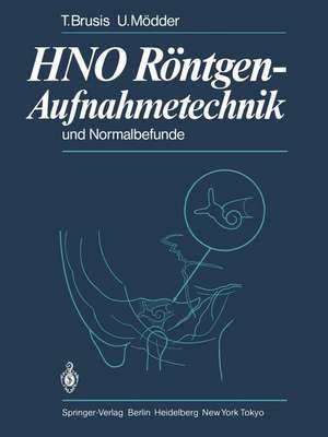 HNO Röntgen-Aufnahmetechnik und Normalbefunde de T. Brusis