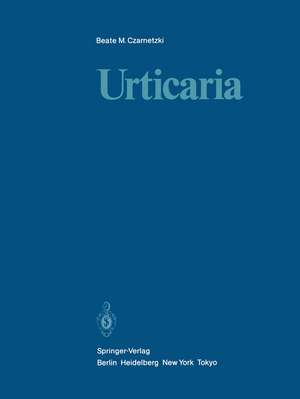 Urticaria de Beate M. Czarnetzki