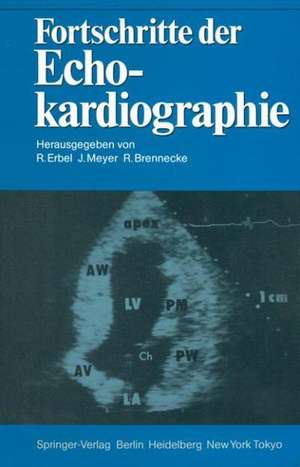 Fortschritte der Echokardiographie de Raimund Erbel