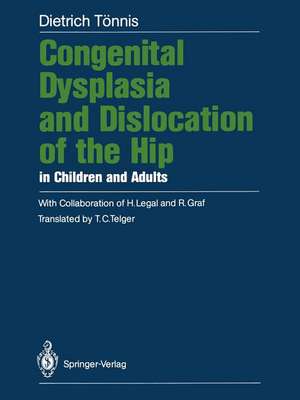 Congenital Dysplasia and Dislocation of the Hip in Children and Adults de Terry C. Telger