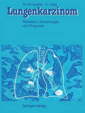 Lungenkarzinom: Resektion, Morphologie und Prognose de Wilhelm-Wolfgang Höpker