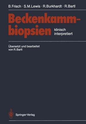 Beckenkammbiopsien: Klinisch Interpretiert de Bertha Frisch