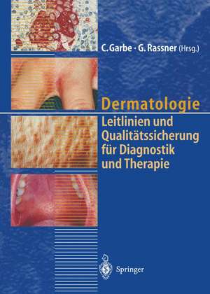 Dermatologie: Leitlinien und Qualitätssicherung für Diagnostik und Therapie Berichte von der 39. Tagung der Deutschen Dermatologischen Gesellschaft de C. Garbe