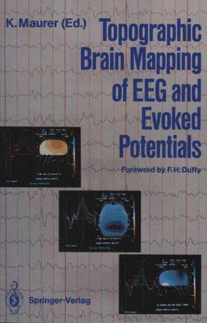 Topographic Brain Mapping of EEG and Evoked Potentials de Konrad Maurer