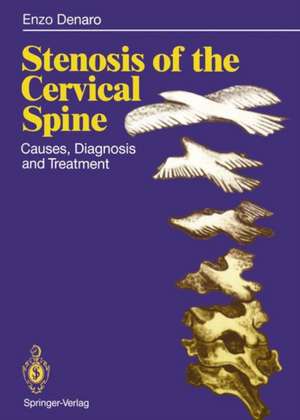 Stenosis of the Cervical Spine: Causes, Diagnosis and Treatment de Vincenzo Denaro