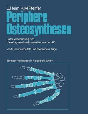 Periphere Osteosynthesen: unter Verwendung des Kleinfragment-Instrumentariums der AO de K. Oberli