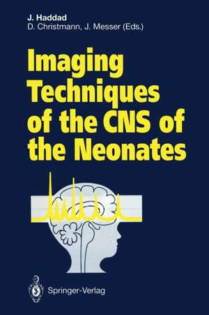 Imaging Techniques of the CNS of the Neonates de Joseph Haddad