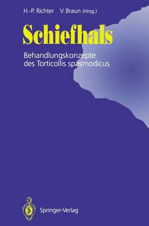 Schiefhals: Behandlungskonzepte des Torticollis spasmodicus de Hans-Peter Richter