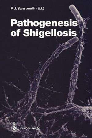 Pathogenesis of Shigellosis de P. J. Sansonetti