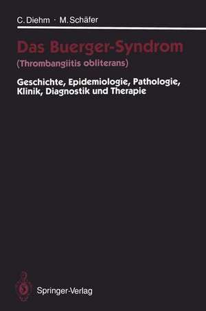 Das Buerger-Syndrom (Thrombangiitis obliterans): Geschichte, Epidemiologie, Pathologie, Klinik, Diagnostik und Therapie de Curt Diehm