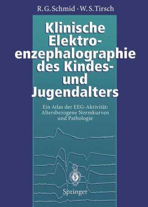 Klinische Elektroenzephalographie des Kindes- und Jugendalters: Ein Atlas der EEG-Aktivität: Altersbezogene Normkurven und Pathologie de J. Kugler