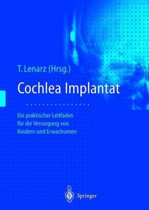 Cochlea-Implantat: Ein praktischer Leitfaden für die Versorgung von Kindern und Erwachsenen de Thomas Lenarz