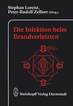 Die Infektion beim Brandverletzten de S. Lorenz