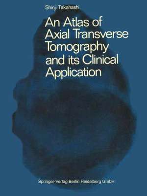 An Atlas of Axial Transverse Tomography and its Clinical Application de A. S. Takahashi