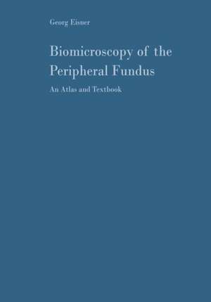 Biomicroscopy of the Peripheral Fundus: An Atlas and Textbook de Georg Eisner