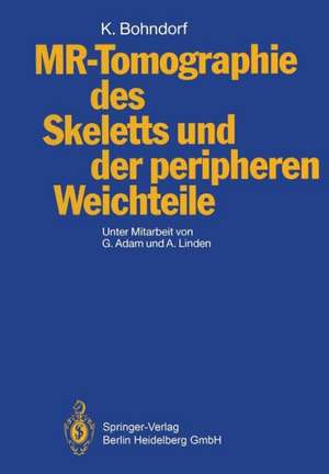 MR-Tomographie des Skeletts und der peripheren Weichteile de Gert Adam