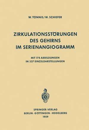 Zirkulationsstörungen des Gehirns im Serienangiogramm de W. Tönnis