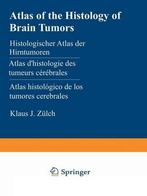 Atlas of the Histology of Brain Tumors / Histologischer Atlas der Hirntumoren / Atlas d’histologie des tumeurs cérébrales / Atlas histológico de los tumores cerebrales / Гистологический атлас опухолей мозга человека de K. J. Zülch